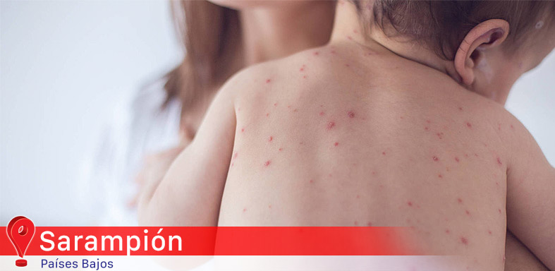Sarampión causa Amnesia Inmunológica
