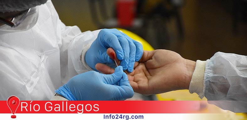 estudio Serológico de Anticuerpos IG G