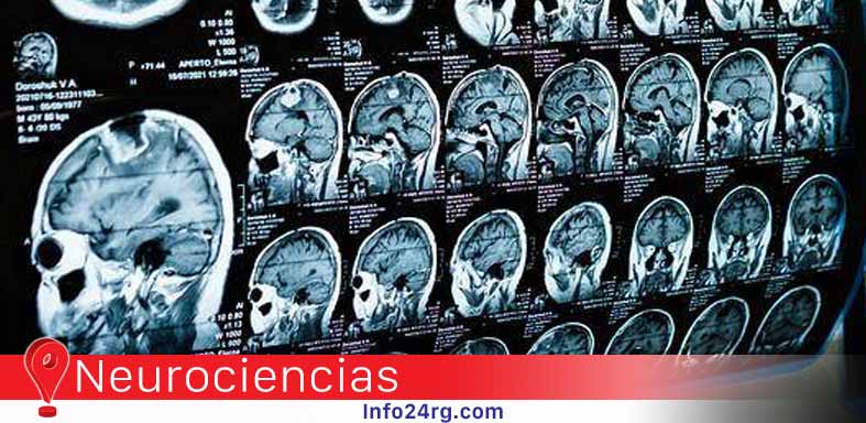 inflamación del cerebro ‘in vivo’