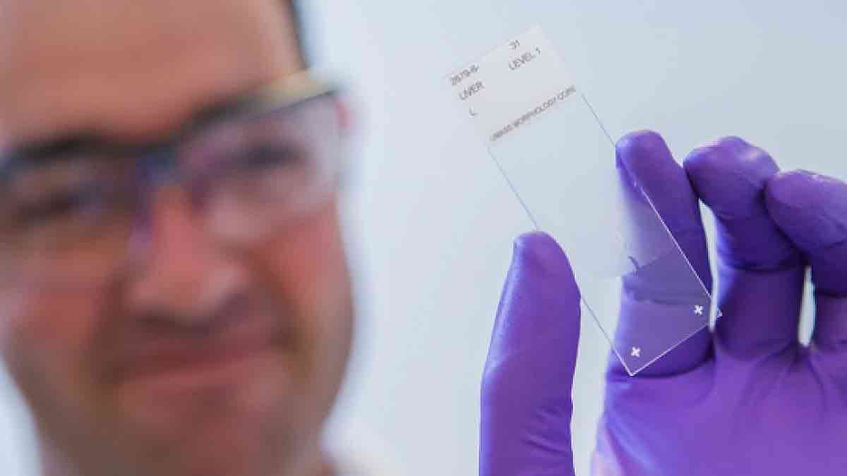Un tratamiento fabricado para cada tumor abre otra etapa contra el cáncer